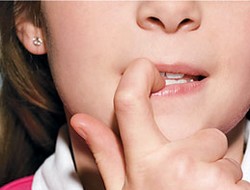 Как отучить ребенка грызть ногти?
